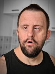 Obraz premium man with down syndrome