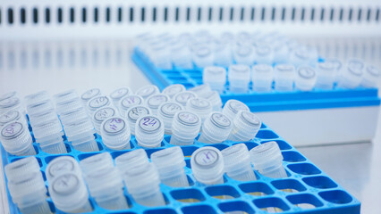 Small test tubes in a blue rack are stacked together. Collection of human antibodies to various...