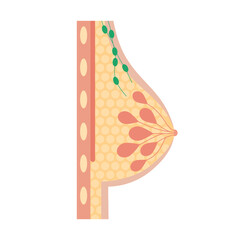 Breast disease concept