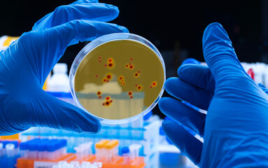 Scientist examines dengue virus on petri dish in laboratory, conceptual image