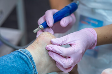 the master pedicure. Podiatry