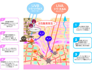 紫外線によるシミ・シワなどの肌トラブル