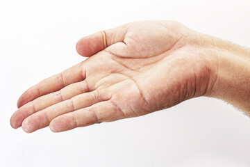 dry hand, without hydration, on isolated white background