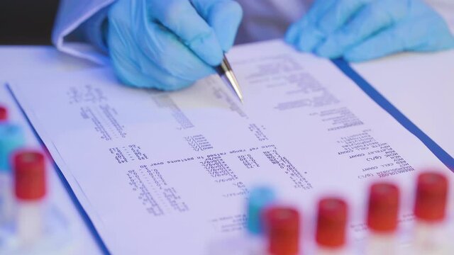 Hands of a doctor or laboratory worker making notes about blood samples on clipboard 