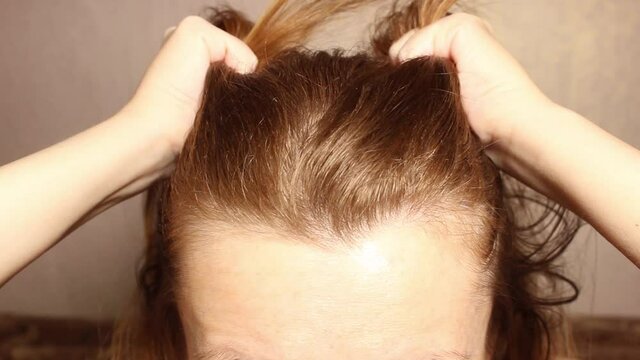 A woman gives herself a massage of the of the head. Improved blood circulation in the head. Close-up of the Upper part of the head.
