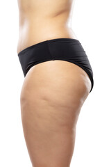 Side view. Overweight woman with fat cellulite legs and buttocks, obesity female body in black...