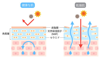 乾燥肌　ビフォアアフター　断面図