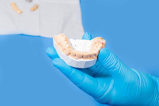 Studio lighting. a man in blue gloves holds a plaster jaw. Close-up.