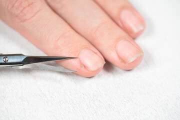 Obraz na płótnie Canvas Closeup view photo of female hand with bad long dirty nails and dry painful skin cuticle. Woman cuts away ugly hangnails using scissors.