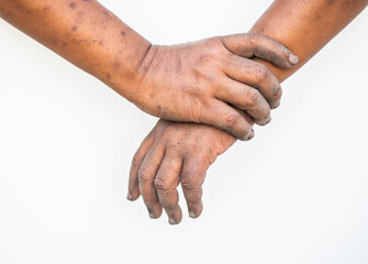 Fototapeta premium Dirty hands holding onto a person on a white background.