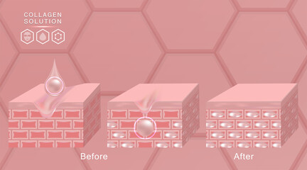 Hyaluronic acid before and after skin solutions ad, pink collagen serum drop with cosmetic advertising background ready to use, illustration vector.