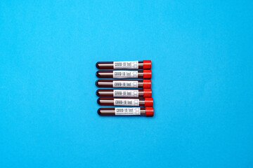 top view of medicine test tubes with blood samples over blue background
