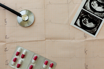 on the table of a gynecologist a medical stethoscope and embryo picture, pills in a blister, cardiogram background