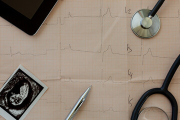 on the table of a gynecologist a medical stethoscope and embryo picture, cardiogram background