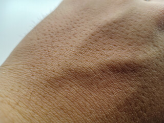 Pores on adult human skin and clear Blood vessels . Close up Asian men skins upper hand with hole and short hair