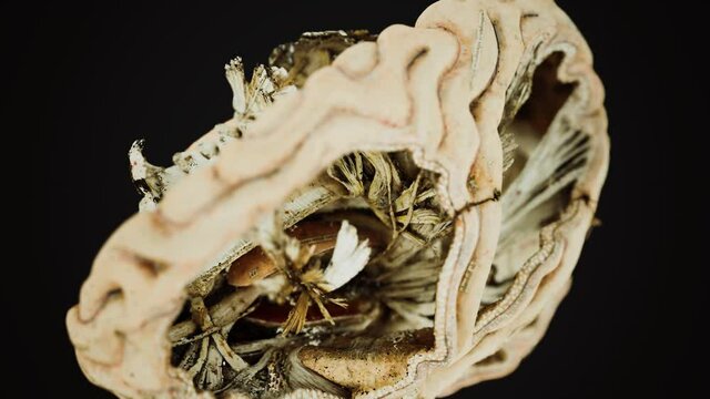 medical anotomy of real human brain