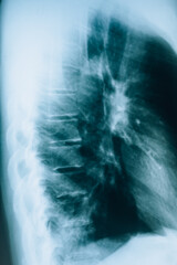 X-ray of human internal organs