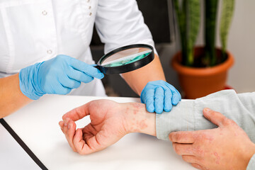 A dermatologist wearing gloves examines the skin of a sick patient. Examination and diagnosis of...