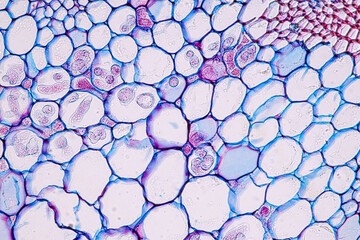 Zygomycota, or zygote fungi ,Downy mildew of cruzifers host tissue with conidia living in decaying...