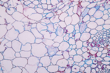 Zygomycota, or zygote fungi ,Downy mildew of cruzifers host tissue with conidia living in decaying plant on Slide under the microscope for education.

