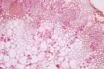 Zygomycota, or zygote fungi ,Downy mildew of cruzifers host tissue with conidia living in decaying...