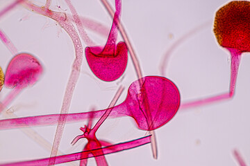  Characteristics of Rhizopus is a genus of common saprophytic fungi  on Slide under the microscope for education.
