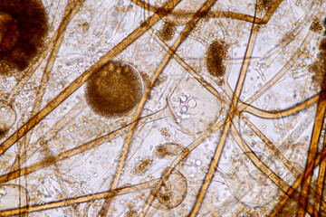  Characteristics of Rhizopus is a genus of common saprophytic fungi  on Slide under the microscope for education.
