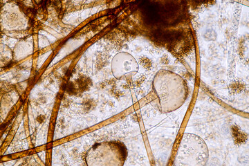  Characteristics of Rhizopus is a genus of common saprophytic fungi  on Slide under the microscope for education.
