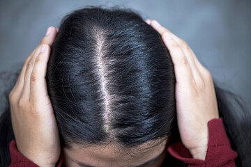 close up woman looks at hair loss.