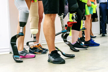 People with disabilities play sports. Running leg prosthesis for an active lifestyle. Many athletes...