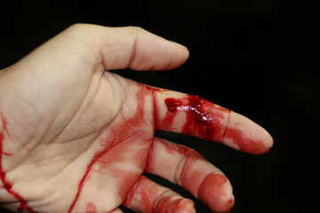 Close up hand injury, Finger cut with knife, real bloody hand