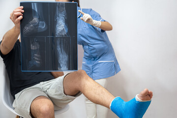 X-ray of a foot fracture close-up on a consultation with a doctor.