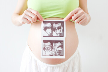 エコー写真を持った妊婦