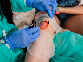 Family doctor treats a wound with an antiseptic on the knee of a teenager child