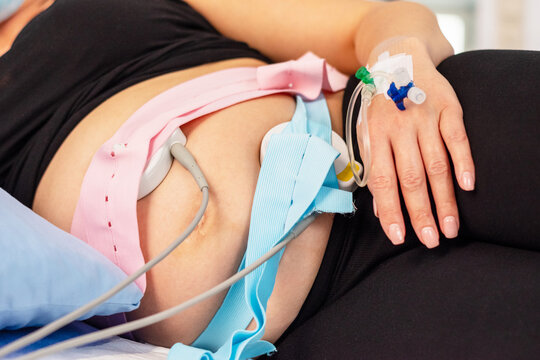 Gro&szlig;aufnahme eines Babybauchs mit angelegtem CTG und Venenkatheter im Handr&uuml;cken vor der Geburt eines Kindes
