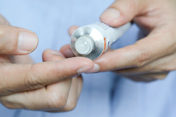 Fototapeta premium The woman's hand, she uses steroids Apply External type