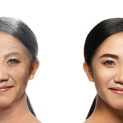 Comparison. Portrait of beautiful asian woman with problem and clean skin, aging and youth concept, beauty treatment and lifting. Before and after. Youth, old age. Process of aging and rejuvenation