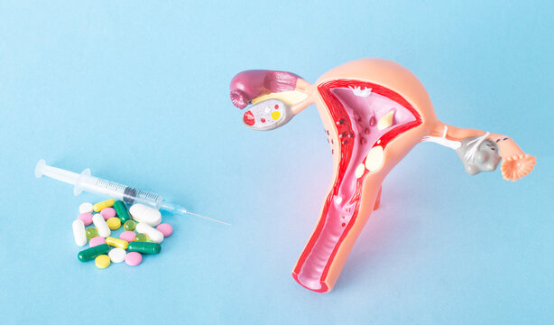 Mock up of the female reproductive system and a bunch of pills and injections on a blue background. Concept of drug treatment of genital infections, antibiotics, trichomoniasis