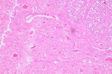 Education Spinal cord  and Motor Neuron under the microscope in Lab.
