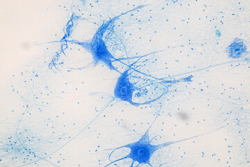 Education Spinal cord  and Motor Neuron under the microscope in Lab.

