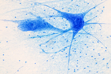 Education Spinal cord and Motor Neuron under the microscope in Lab. 