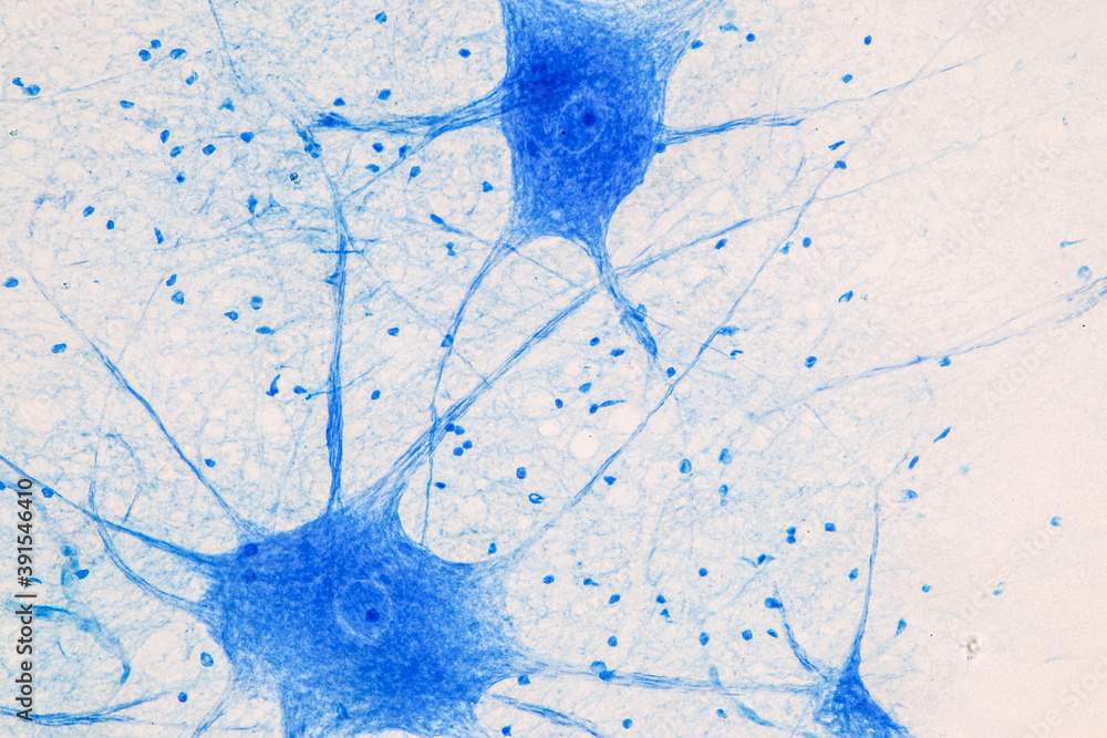 Wall mural Education Spinal cord  and Motor Neuron under the microscope in Lab.
