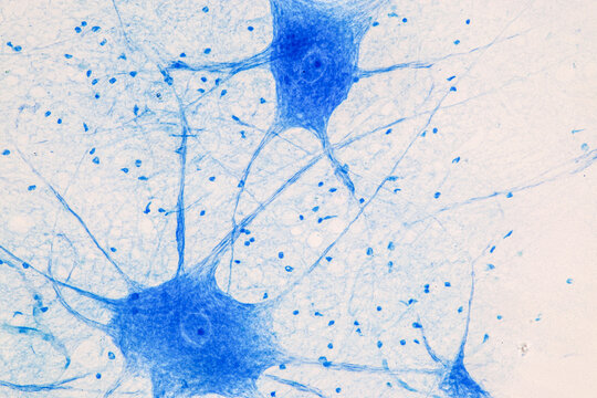 Education Spinal cord  and Motor Neuron under the microscope in Lab.
