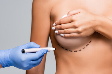 Cropped view of doctor in latex glove holding marker near naked woman with marks on breast isolated...