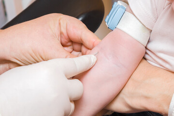 Doctor hand in rubber protective glove using syringe and taking blood from vein of baby arm. Visit to physician at office. Closeup.