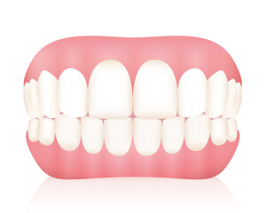 Dentures. False teeth. Isolated vector illustration on white background.
