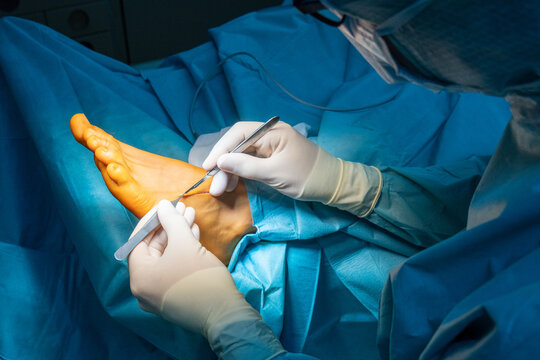 a surgeon makes an incision on one foot with a scalpel