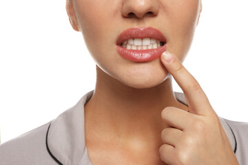 Obraz premium Woman with herpes touching lips on white background, closeup
