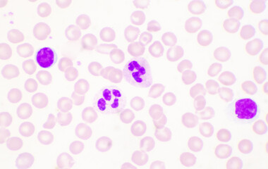 Mature lymphocyte on red blood cells background.