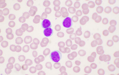Mature lymphocyte on red blood cells background.